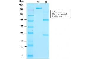 SDS-PAGE Analysis Purified Thyroglobulin Mouse Recombinant Monoclonal Antibody (r2H11). (Recombinant Thyroglobulin 抗体)