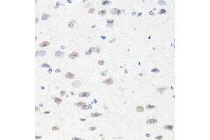 Immunohistochemistry of paraffin-embedded rat brain using CHD1 antibody (ABIN5975217) at dilution of 1/100 (40x lens). (CHD1 抗体)