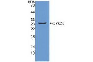 Detection of Recombinant PRSS2, Human using Polyclonal Antibody to Protease, Serine 2 (PRSS2) (PRSS2 抗体  (AA 24-241))
