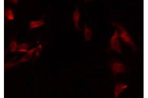 Immunofluorescence (fixed cells) (IF/ICC) image for anti-NADH Dehydrogenase (Ubiquinone) 1 alpha Subcomplex, 8, 19kDa (NDUFA8) (Internal Region) antibody (ABIN6259121)
