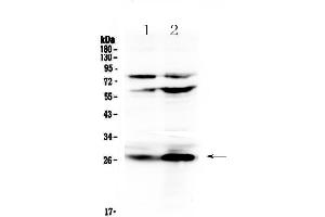 Western blot analysis of Factor D using anti-Factor D antibody . (Adipsin 抗体  (AA 26-263))