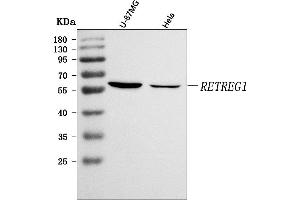 Western blot analysis of RETREG1 using anti-RETREG1 antibody (ABIN7599962).
