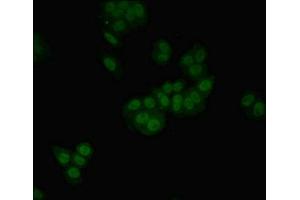 Immunofluorescent analysis of HepG2 cells using ABIN7155891 at dilution of 1:100 and Alexa Fluor 488-congugated AffiniPure Goat Anti-Rabbit IgG(H+L) (HGD 抗体  (AA 226-445))