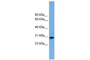 RCAN2 antibody used at 0. (RCAN2 抗体  (Middle Region))