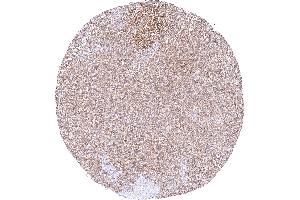 Moderate predominantly cytoplasmic MTAP staining of ovarian stroma cells (Recombinant MTAP 抗体  (AA 95-197))