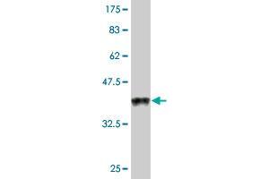Western Blot detection against Immunogen (38. (Ghrelin 抗体  (AA 1-117))