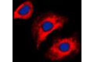Immunofluorescence (IF) image for anti-Collagen, Type III, alpha 1 (COL3A1) (N-Term) antibody (ABIN7295320)