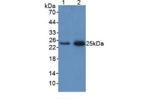 Figure. (Lipocalin 2 抗体  (AA 21-198))