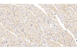 Immunohistochemistry (IHC) image for anti-Sema Domain, Seven Thrombospondin Repeats (Type 1 and Type 1-Like), Transmembrane Domain (TM) and Short Cytoplasmic Domain, (Semaphorin) 5B (SEMA5B) (AA 350-602) antibody (ABIN7438508)