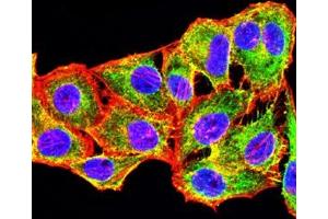 Immunofluorescence analysis of Hela cells using CD267 mouse mAb (green).