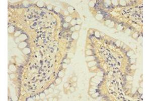 Immunohistochemistry of paraffin-embedded human small intestine tissue using ABIN7170961 at dilution of 1:100 (SULT1B1 抗体  (AA 1-271))