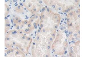 DAB staining on IHC-P; Samples: Human Kidney Tissue (TRAF4 抗体  (AA 193-444))