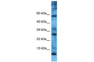 Western Blotting (WB) image for anti-Mitochondrial Ribosomal Protein L52 (MRPL52) (N-Term) antibody (ABIN2791671) (MRPL52 抗体  (N-Term))