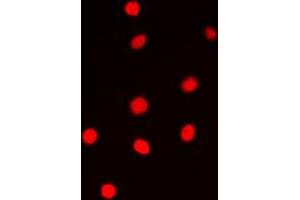 Immunofluorescent analysis of Cyclin E1 staining in PC12 cells. (Cyclin E1 抗体  (Center))