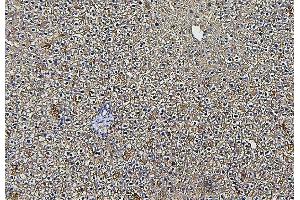 IHC analysis of ALDOB using anti-ALDOB antibody (ABIN7602563). (ALDOB 抗体  (AA 85-364))