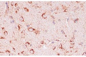 Immunohistochemistry of paraffin-embedded Rat brain using ENTPD6 Polyclonal Antibody at dilution of 1:100 (40x lens). (ENTPD6 抗体)