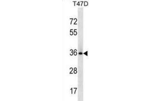 Western Blotting (WB) image for anti-BCL2-Like 12 (Proline Rich) (BCL2L12) antibody (ABIN3000719) (BCL2L12 抗体)