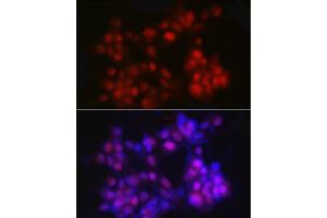 Immunofluorescence analysis of LNCaP cells using NKX3. (NKX3-1 抗体)