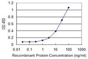 Detection limit for recombinant GST tagged EVC is 0. (EVC 抗体  (AA 493-602))
