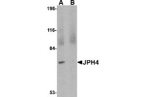 Western Blotting (WB) image for anti-Junctophilin 4 (JPH4) (C-Term) antibody (ABIN1030461) (Junctophilin 4 抗体  (C-Term))