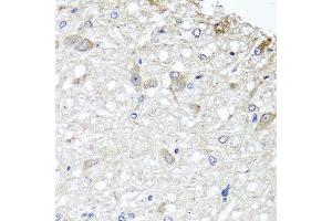 Immunohistochemistry of paraffin-embedded rat brain using METTL13 antibody at dilution of 1:100 (x40 lens). (METTL13 抗体)
