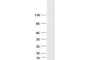 Western Blotting (WB) image for Ankyrin Repeat-Containing Protein (EHMT2) protein (Myc-DYKDDDDK Tag) (ABIN2715160)