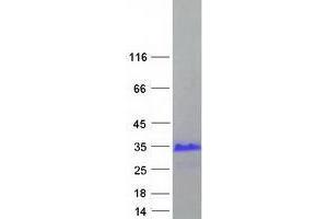 Western Blotting (WB) image for X Antigen Family, Member 3 (XAGE3) (Transcript Variant 2) protein (Myc-DYKDDDDK Tag) (ABIN2735655)