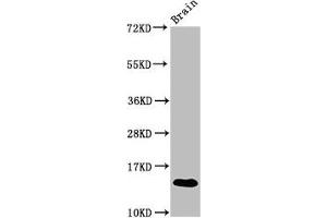 Western Blot Positive WB detected in: Mouse brain tissue All lanes: S100a9 antibody at 3. (S1A9 (AA 2-113) 抗体)