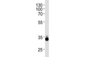 OTX2 antibody western blot analysis in Y79 lysate (OTX2 抗体  (AA 261-289))