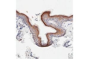 Immunohistochemistry (Paraffin-embedded Sections) (IHC (p)) image for anti-Sciellin (SCEL) (AA 260-289) antibody (ABIN655511)