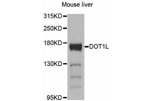 Western blot analysis of extracts of mouse liver, using DOT1L antibody (ABIN6292027) at 1:1000 dilution. (DOT1L 抗体)