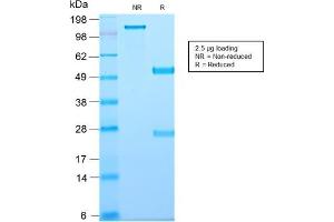 SDS-PAGE Analysis Purified CD81 Rabbit Recombinant Monoclonal Antibody (C81/2885R). (Recombinant CD81 抗体)