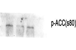 Western Blot (WB) analysis: Please contact us for more details. (Acetyl-CoA Carboxylase alpha 抗体  (pSer80))