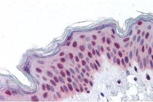 Human Skin: Formalin-Fixed, Paraffin-Embedded (FFPE) (RUVBL2 抗体  (AA 304-458))