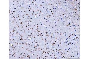 IHC analysis of HnRNP H/HNRNPH1 using anti-HnRNP H/HNRNPH1 antibody (ABIN4886623). (HNRNPH1 抗体  (N-Term))