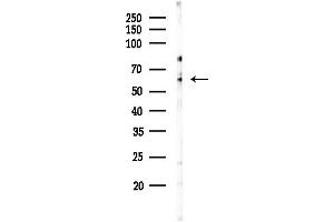 anti-Solute Carrier Family 16 Member 2 (SLC16A2) (Internal Region) antibody