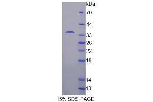 SDS-PAGE analysis of Human CDK18 Protein. (CDK18 蛋白)