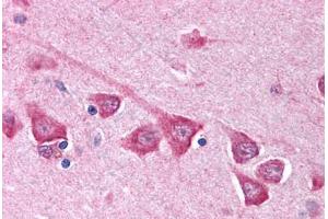 Immunohistochemistry (IHC) image for anti-Sodium Channel, Voltage-Gated, Type III, beta Subunit (SCN3B) (AA 65-114) antibody (ABIN214184)