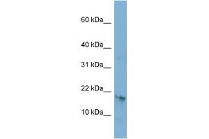 WB Suggested Anti-C17orf64 Antibody Titration: 0. (C17orf64 抗体  (Middle Region))