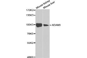 Western blot analysis of extracts of various cell lines, using ADAM9 antibody (ABIN5973121) at 1/1000 dilution. (ADAM9 抗体)