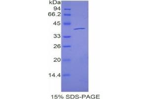 SDS-PAGE analysis of Mouse Angiopoietin 4 Protein. (Angiopoietin 4 Protein (ANGPT4))