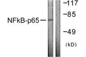 Western blot analysis of extracts from HeLa cells, using NF-kappaB p65 (Ab-505) Antibody. (NF-kB p65 抗体  (AA 471-520))