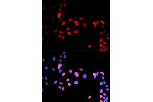 Immunofluorescence analysis of U2OS cell using Phospho-MAX-S11 antibody. (MAX 抗体  (pSer11))