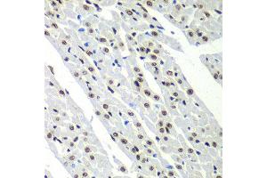 Immunohistochemistry of paraffin-embedded rat heart using SF3B2 antibody at dilution of 1:100 (40x lens).