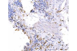 IHC analysis of SH3GL2 using anti-SH3GL2 antibody (ABIN7602229). (SH3G2 抗体  (AA 65-292))