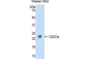 Western blot analysis of the recombinant protein. (LEFTY1 抗体  (AA 167-332))