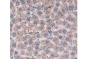 Used in DAB staining on fromalin fixed paraffin- embedded Kidney tissue (CD109 抗体  (AA 719-965))