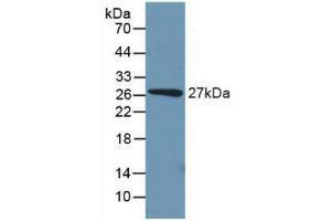 Detection of Recombinant PCK1, Mouse using Polyclonal Antibody to Phosphoenolpyruvate Carboxykinase 1, Soluble (PCK1) (PCK1 抗体  (AA 312-563))
