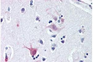 Immunohistochemical staining of human brain, cortex with WNT8B polyclonal antibody . (WNT8B 抗体  (C-Term))