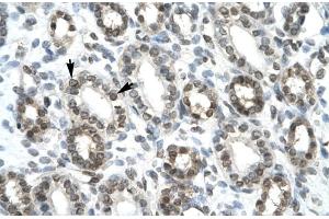 Rabbit Anti-HEY1 Antibody ,Paraffin Embedded Tissue: Human Kidney  Cellular Data: Epithelial cells of renal tubule  Antibody Concentration: 4. (HEY1 抗体  (C-Term))